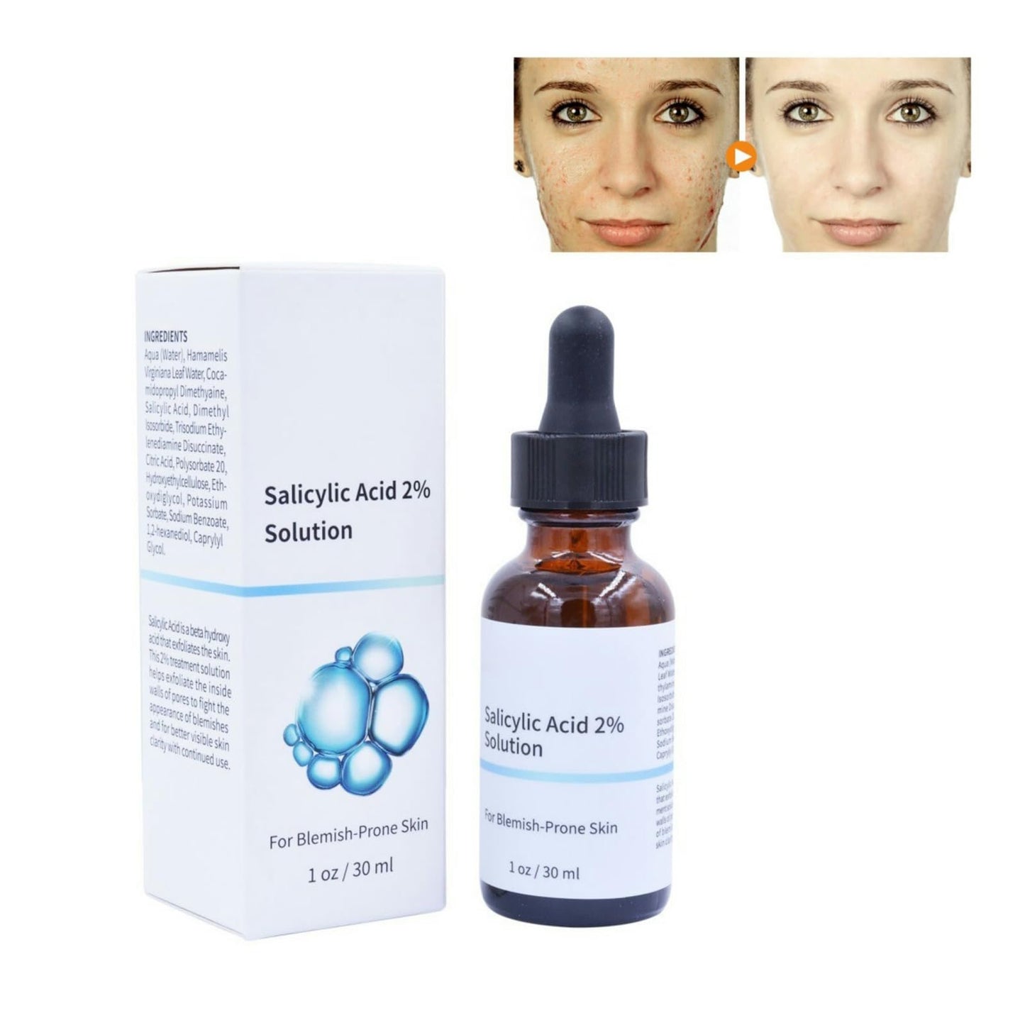 Salicylic Acid Concentrate Super Strong 2% - Acne Spot Treatment - Professional Skincare Serum