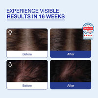 COSMERNA CosmeRNA Hair Revitalizing Tonic 2ml with Once a week Application for Healthy Hair for Women and Men