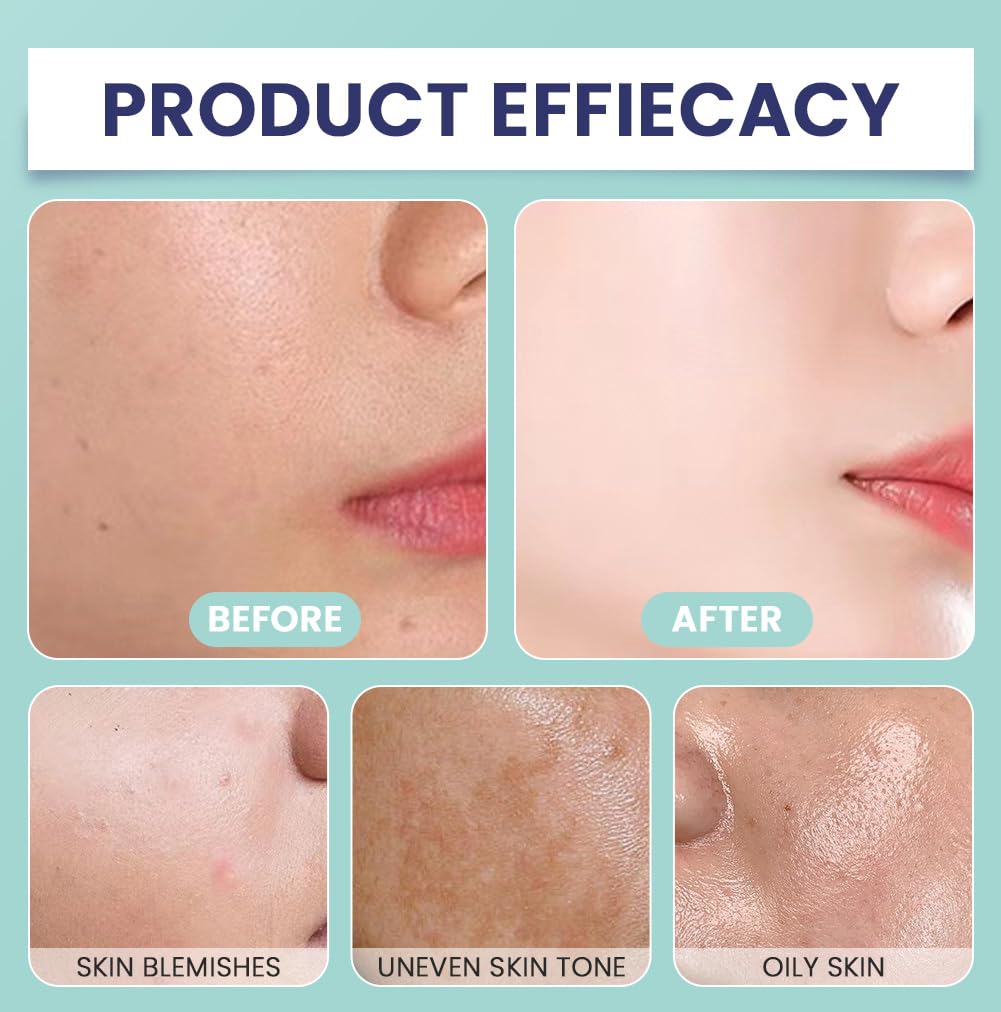 LOPHE Body Coverage Perfector, Leg Makeup Waterproof No Transfer Full Coverage Body Makeup Scar Tattoo Cover Up Cover Veins Concealer Light Concealing Foundation Cream for Body Face Makeup