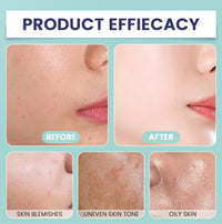 LOPHE Body Coverage Perfector, Leg Makeup Waterproof No Transfer Full Coverage Body Makeup Scar Tattoo Cover Up Cover Veins Concealer Light Concealing Foundation Cream for Body Face Makeup