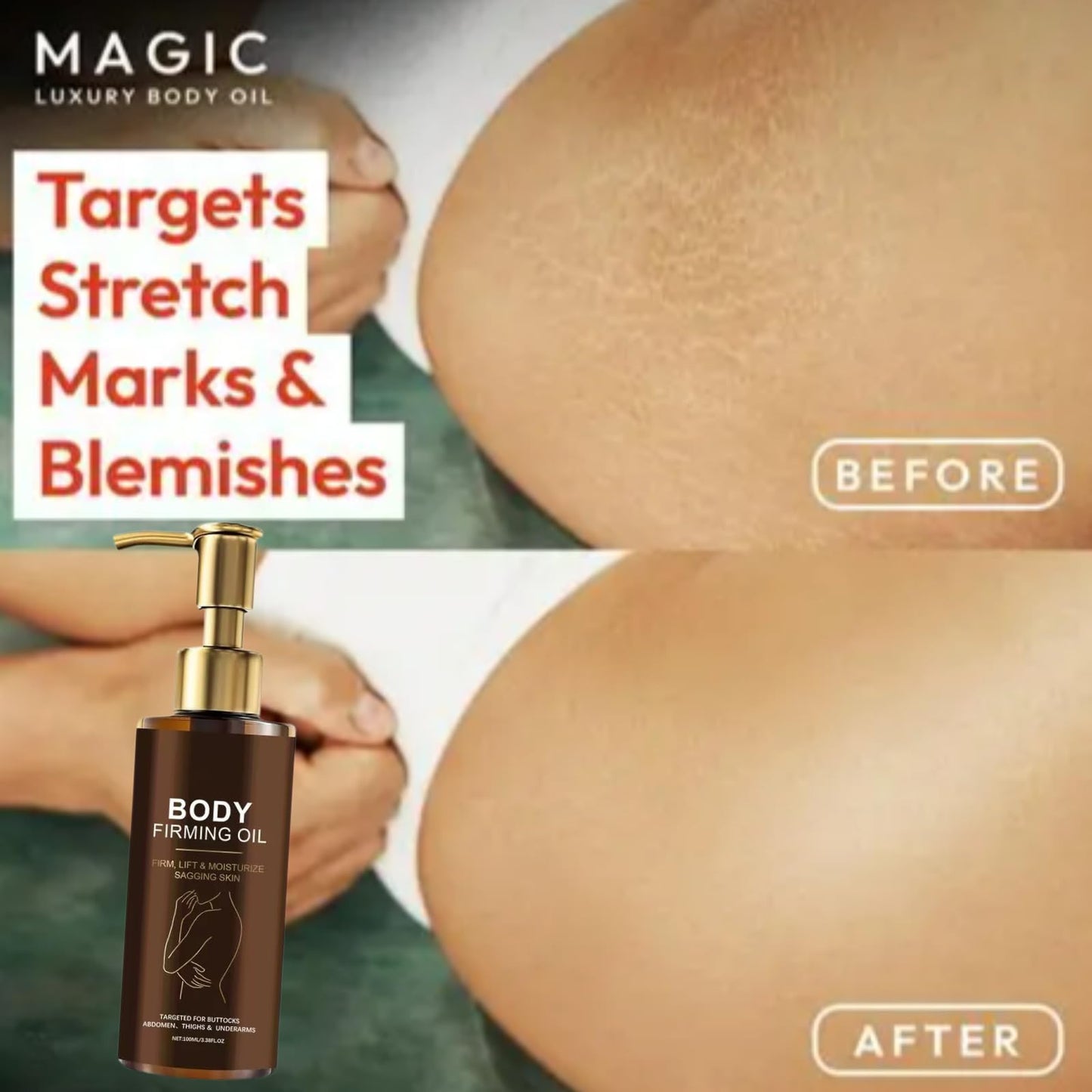 jinyue Glow Remedy O-il,Glow Remedy O-il Skin Tightening,Magic Body Firming Oil,Magic Luxury Body Firming Oil for Saggy Skin,Reduces Wrinkles, Fine Lines & Stretch Marks, 100ml