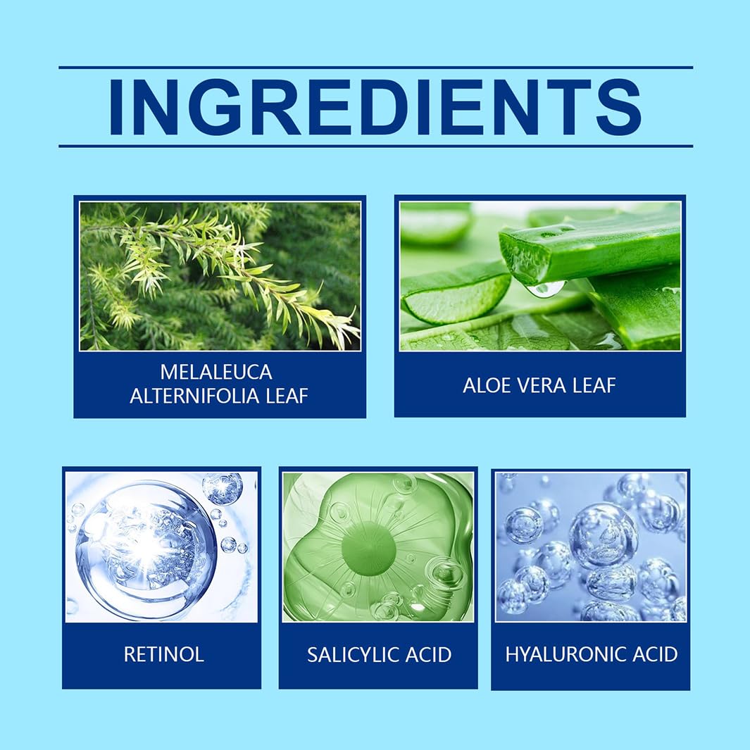 Retinol Gel,Retinol Gel for Face, Retinol Acne Treatment Gel & Skin Soothing Cream,Anti-Acne Moisturizer with Retinol, Spot Treatment for Acne-Prone Skin, Oil-Free,Non-Comedogenic