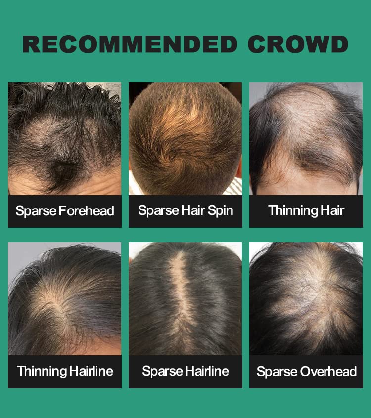 UOYOU MEDIUM BROWN Hair Fibres for Thinning Hair 27.5g Bottle with Applicator | Natural Keratin Hair Fibers Concealer for Hair Loss for Men and Women | Hair Building Fibres Powder [MEDIUM BROWN]