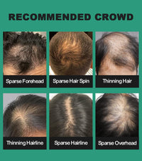 UOYOU MEDIUM BROWN Hair Fibres for Thinning Hair 27.5g Bottle with Applicator | Natural Keratin Hair Fibers Concealer for Hair Loss for Men and Women | Hair Building Fibres Powder [MEDIUM BROWN]