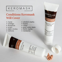 Keromask Full Coverage Hypoallergenic Concealer Shade LIGHT No 9 to Camouflage Vitiligo, Tattoos, Redness and Rosacea, Waterproof and Suitable for All Skin Types 1 x 15ml