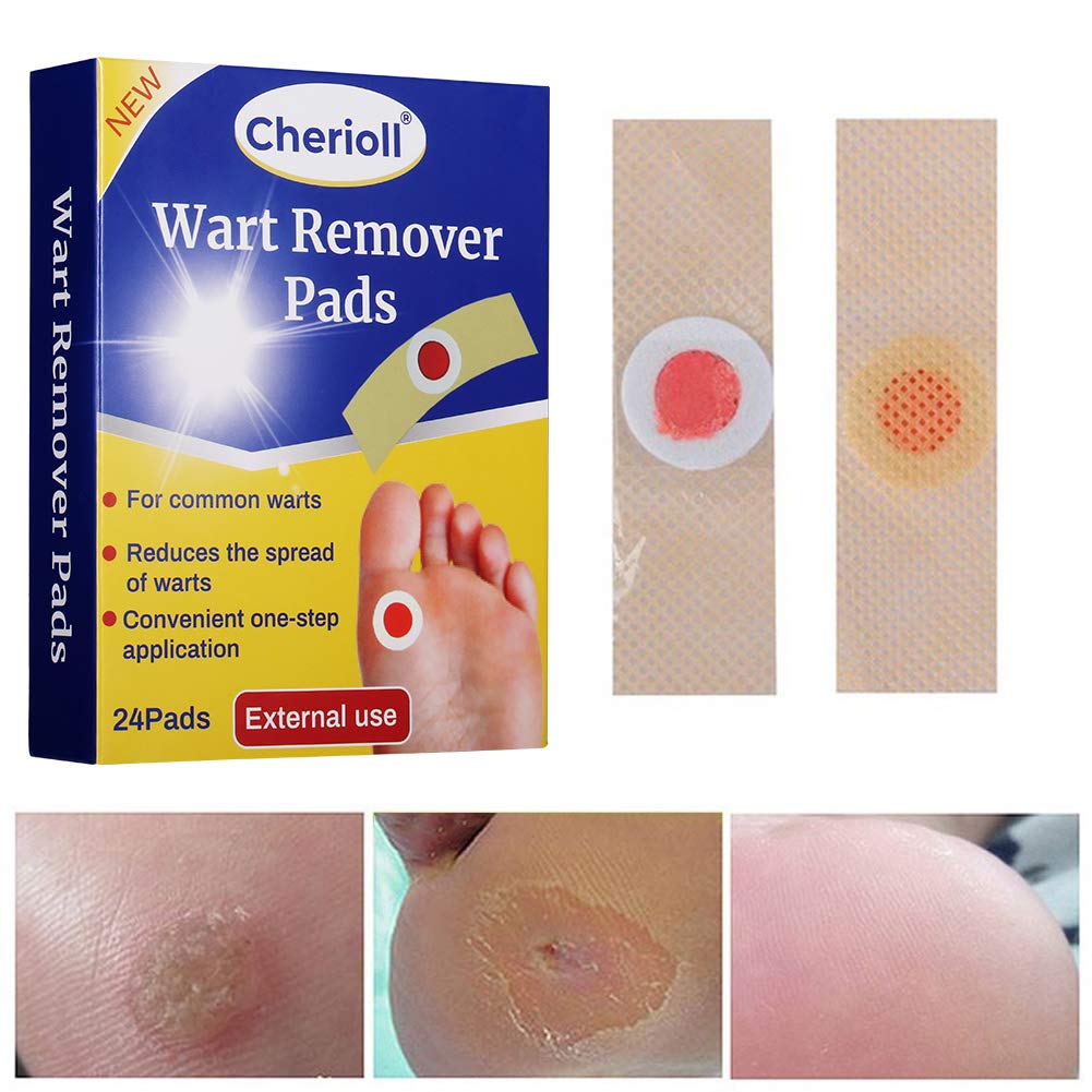 Cherioll Wart Remover, Corn Complete Removal, Corn Remover, Foot Corn Remover Pads, Plantar Wart Removal, Penetrates and Removes Common and Plantar Warts, Callus, Stops Wart Regrowth