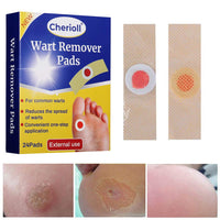 Cherioll Wart Remover, Corn Complete Removal, Corn Remover, Foot Corn Remover Pads, Plantar Wart Removal, Penetrates and Removes Common and Plantar Warts, Callus, Stops Wart Regrowth