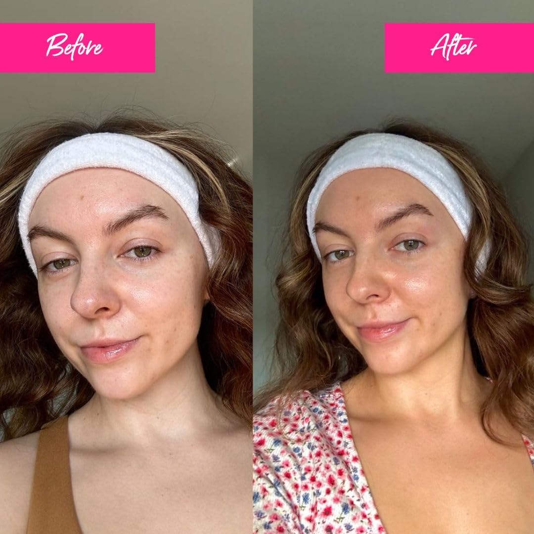 Skinny Tan Notox Moisturising Face Tanning Drops - Gradual Fake Tan Face Serum with Vegan Collagen, Cruelty-Free, Paraben Free & Vegan Skincare - Dark Self Tan, 30ml