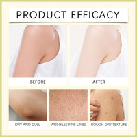 6PCS Chinese Body Cream,Clarifying Botanical Natural Face Cream Set,Soothing and Balancing Skin Smiles and Joys Cream,East Asia BodyCream for Skincare,VersatileCream Plant Essences For Dry Skin Relief