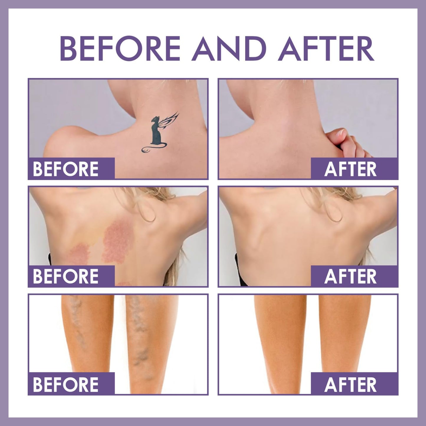 SHEBEEDO Body Concealer Tattoo Cover Up Makeup And Leg Makeup To Cover Veins Waterproof Concealer For Tattoo Hidden Spot And Scars Dark Spots Concealer Full Coverage Natural Radiance