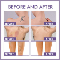 SHEBEEDO Body Concealer Tattoo Cover Up Makeup And Leg Makeup To Cover Veins Waterproof Concealer For Tattoo Hidden Spot And Scars Dark Spots Concealer Full Coverage Natural Radiance