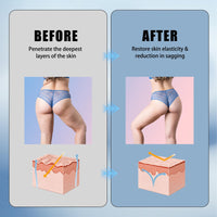 Nadiaen Skin Firming Youth Butter,Skin Firming Cream,Skin Firming Body Cream,Skin Tightening,Suitable for Sagging Skin,Used for Anti-Aging,Firming,Improving Wrinkles and Reducing Skin Dryness (80ml×2)