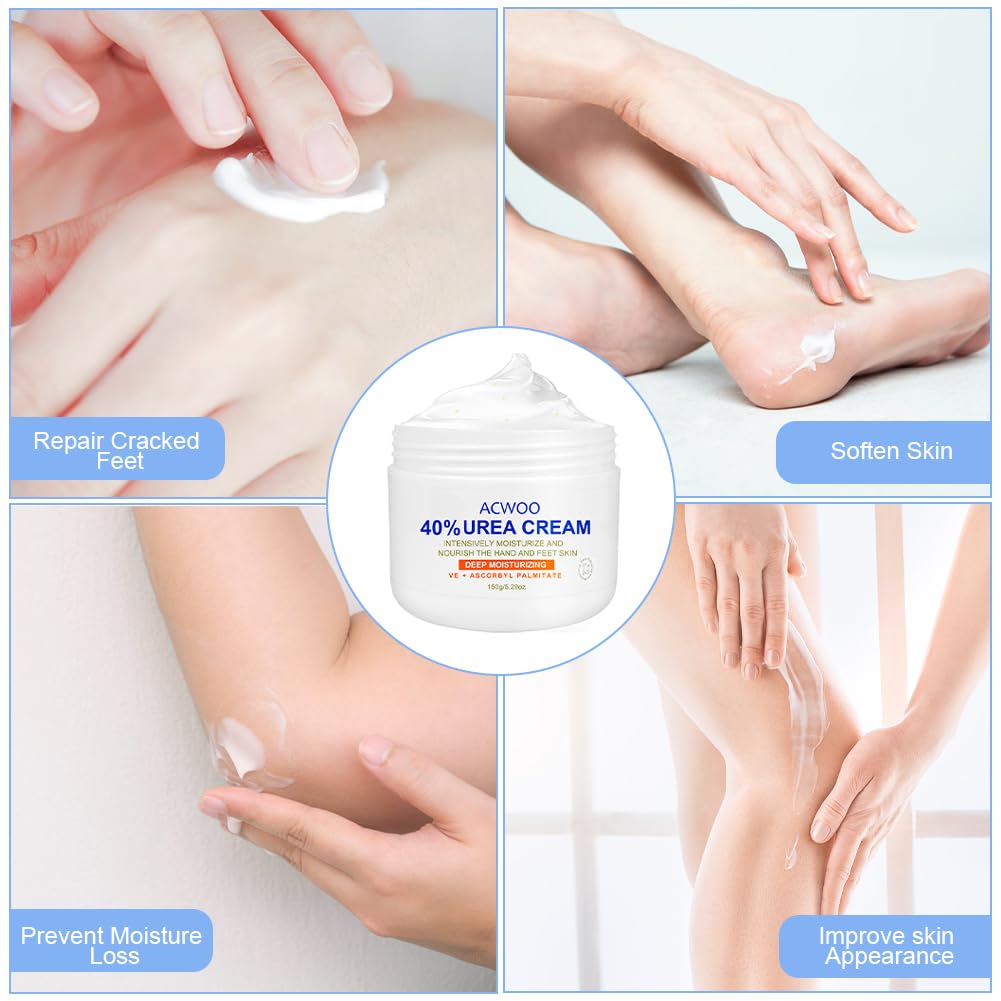 ACWOO Urea Cream 40%, Urea Foot Cream, 150g Urea Cream for Feet, Urea Foot & Hand Cream for Cracked Heels and Dry Skin, Foot Nourishing Frost for Callus Remover, 40% Urea Lotion for Feet