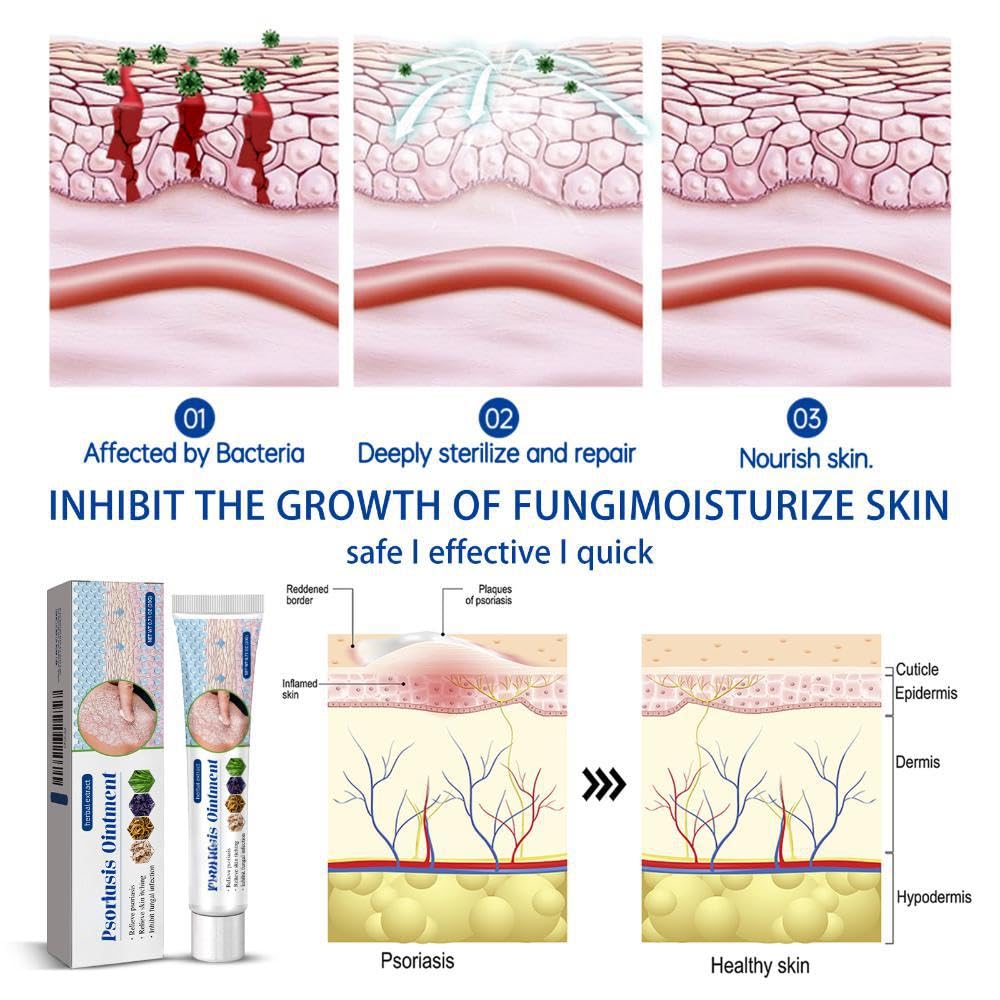 Herbal Skin Relief Cream with Aloe Vera – Soothing Moisturizer for Dry Skin – Lightweight, Non-Greasy Daily Hydration for All Types（2pcs） (2PCS)