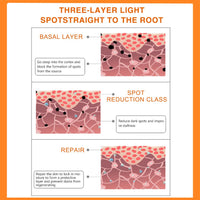 KUIRUNRX® Vitamin C Lightening Balm, Underarm Sweat Cream, Armpit Odor Cream, Corrector for Dark Spots, Brightens the Skin and Nourishes the Skin for Elbows (40G)