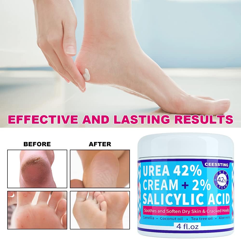 ENVISHA Urea Cream 42 Percent for Feet - 42% Urea Foot Cream with 2% Salicylic Acid & Hyaluronic Acid - For Feet, Hands, Heels, Elbows, Nails & Knees - 4 oz
