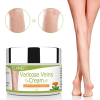Solotree Varicose Veins Cream, Varicose Vein Treatment, Spider Vein Treatment Cream for Legs, Improve Blood Circulation, Tired and Heavy Legs Fast Relief
