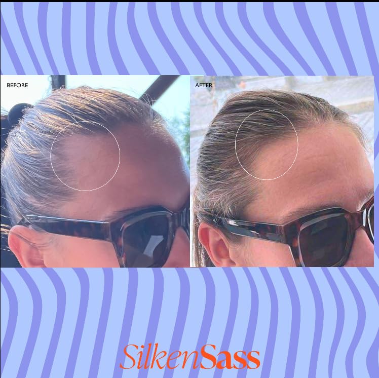 Silken Sass DHT Blocker Shampoo for Women – Root Revival Hair Growth Cleanser with Redensyl® & Saw Palmetto – Botanical Formula for Thinning Hair, Breakage & Menopause Hair Care