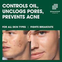 Shakeup Cosmetics Mens Face Toner - Glycolic Acid Exfoliating Toner for Men with Witch Hazel - Clarifying Skin Toner Reduces Pores, Oil and Ingrown Hairs, Fragrance Free, 200ml (Face 4ward)