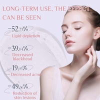 Azelaic Acid 15% Acne Tratment Gel,Azelaic Acid Serum Cream with Niacinamide & Vitamin C,Anti Acne Gel for Spot Prone Skin,Face Serum for Women,Hydrating Serum,Moisturiser Face,Serums Skincare