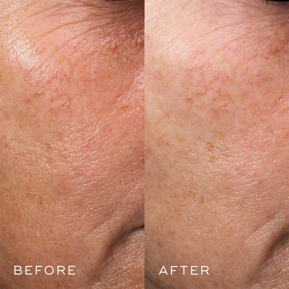 Medik8 Crystal Retinal 6, 30ml