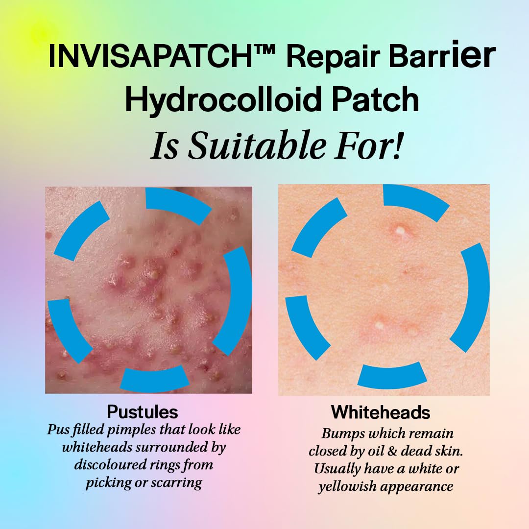 the superdots. The Superdots Invisapatch Repair Barrier, 44 Ultra-Thin Spot Patches