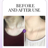 Skin Tightening Cream with Collagen & Retinol Firms Neck Skin Reduces Fine Lines Double Chin Dual Roller Massage Design for All Skin Types