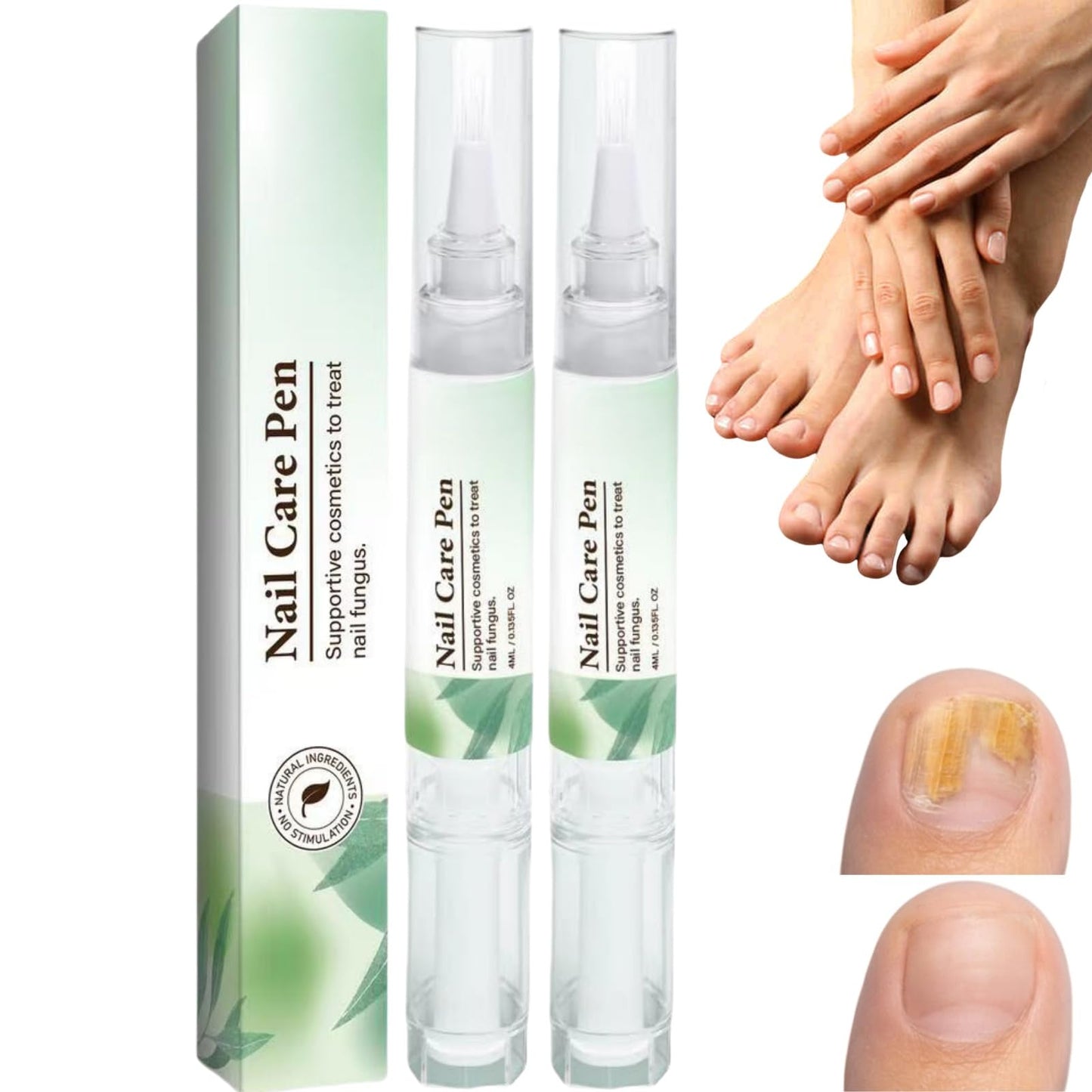 2PCS Nail Care Pen & Serum,Nail Revive Pen,Fungel Nail Treatmant Pe/n,Toena/il Fungas Treatmant P/en,To/enails Repair Pe/n,Nai/l Repair Essence for Toena/il and Fingernails,Fungel N/ail trea/tmant