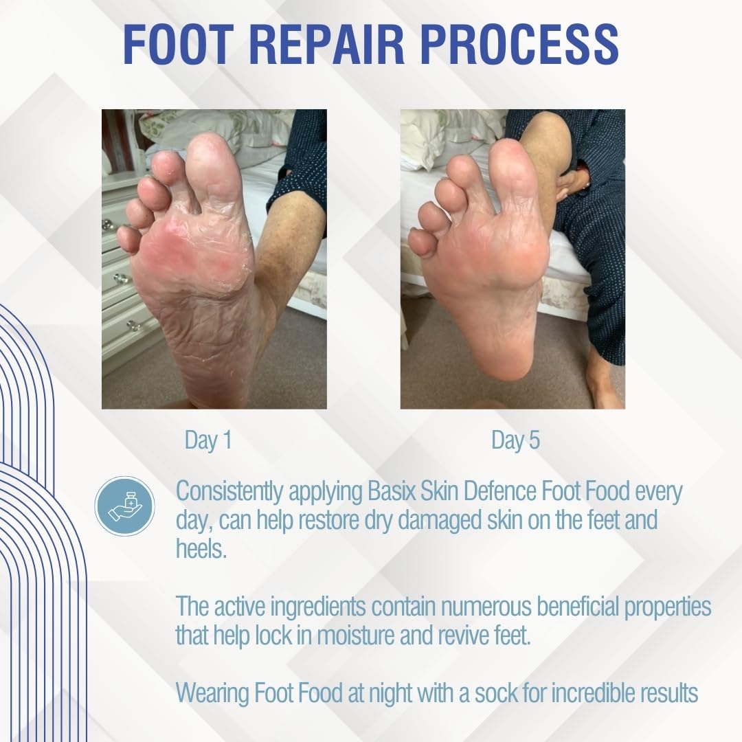 Basix Skin Defence Cream Foot Food [TWIN PACK 2x50ml] Foot Repair Restoration Balm for Dry Feet and Cracked Heels - 5% Urea Peppermint Oil Soothes, Moisturises, Stimulates and Invigorates Tired Feet