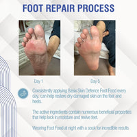 Basix Skin Defence Cream Foot Food [TWIN PACK 2x50ml] Foot Repair Restoration Balm for Dry Feet and Cracked Heels - 5% Urea Peppermint Oil Soothes, Moisturises, Stimulates and Invigorates Tired Feet
