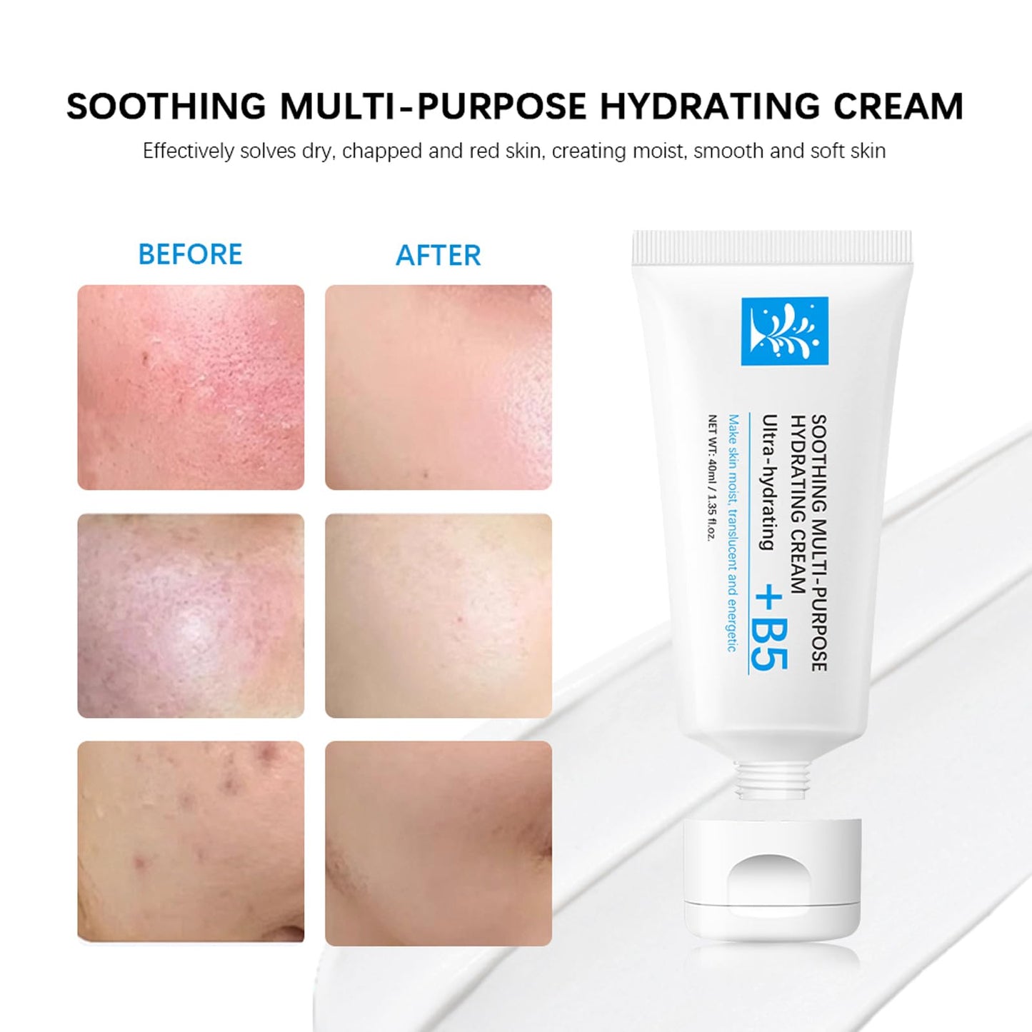 HERBENJOY B5 Repair Face Cream, Skin Barrier Repairing Cream, Vitamin B5 Soothing Day Cream for Anti Redness, Firming Face Cream For Sensitive Skin, Acne & Repair Damage Skin (2PC)