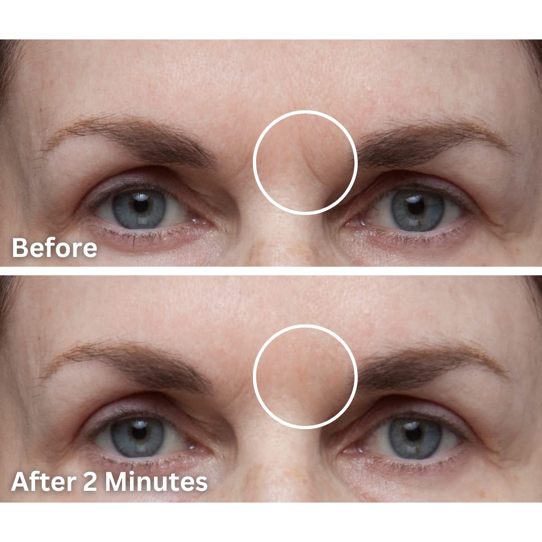 Dermaflage Cover Up - Concealer for Scars, Frown Lines from Hollywood Pro