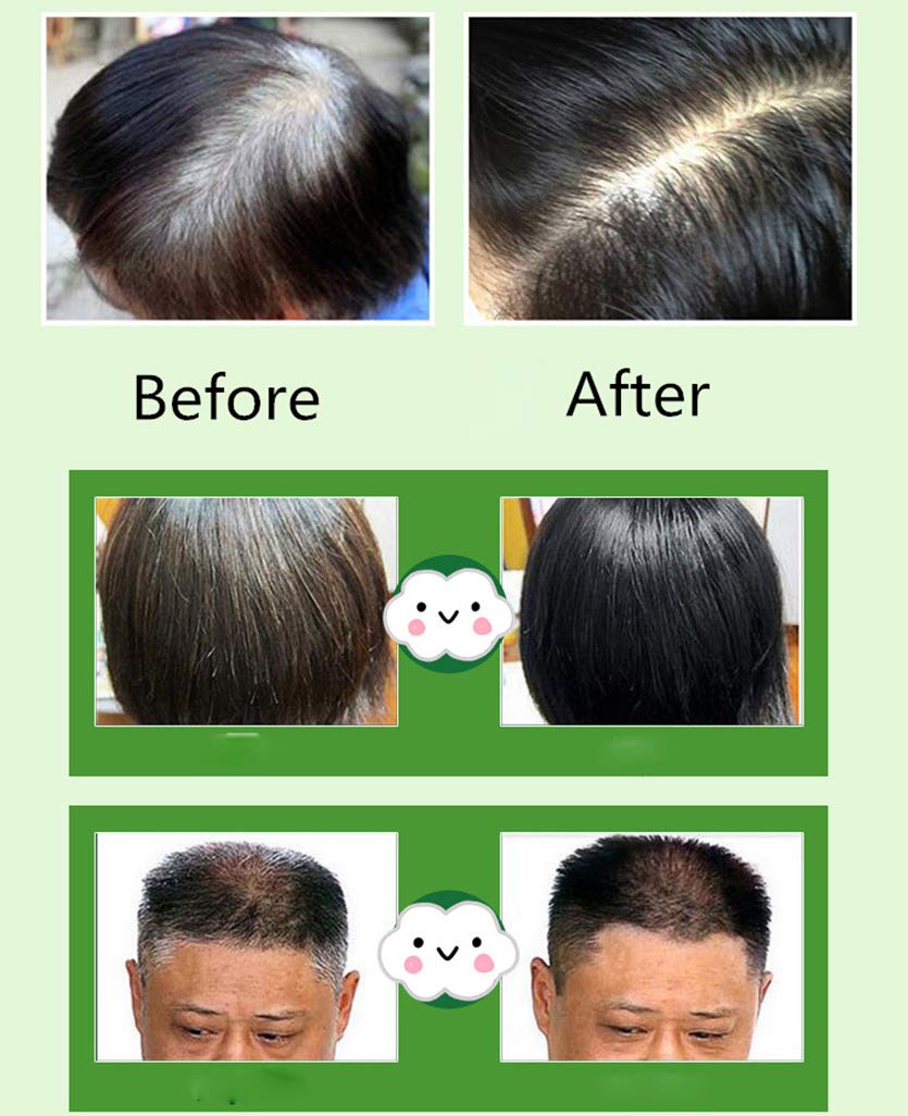 Black Hair Shampoo,MQUPIN Instant Black Natural Ingredients Hair Dye Shampoo Semi-Permanent Black Hair Color,Easy to use,Long lasting,(10 Pack, Black)