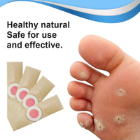 GNAPY Wart Removal Plasters, 24Pcs Wart Remover for Hands Feet Corn Removal Plaster with Hole, Remover Plantar Warts, Callus, Stops Wart Regrowth (A)
