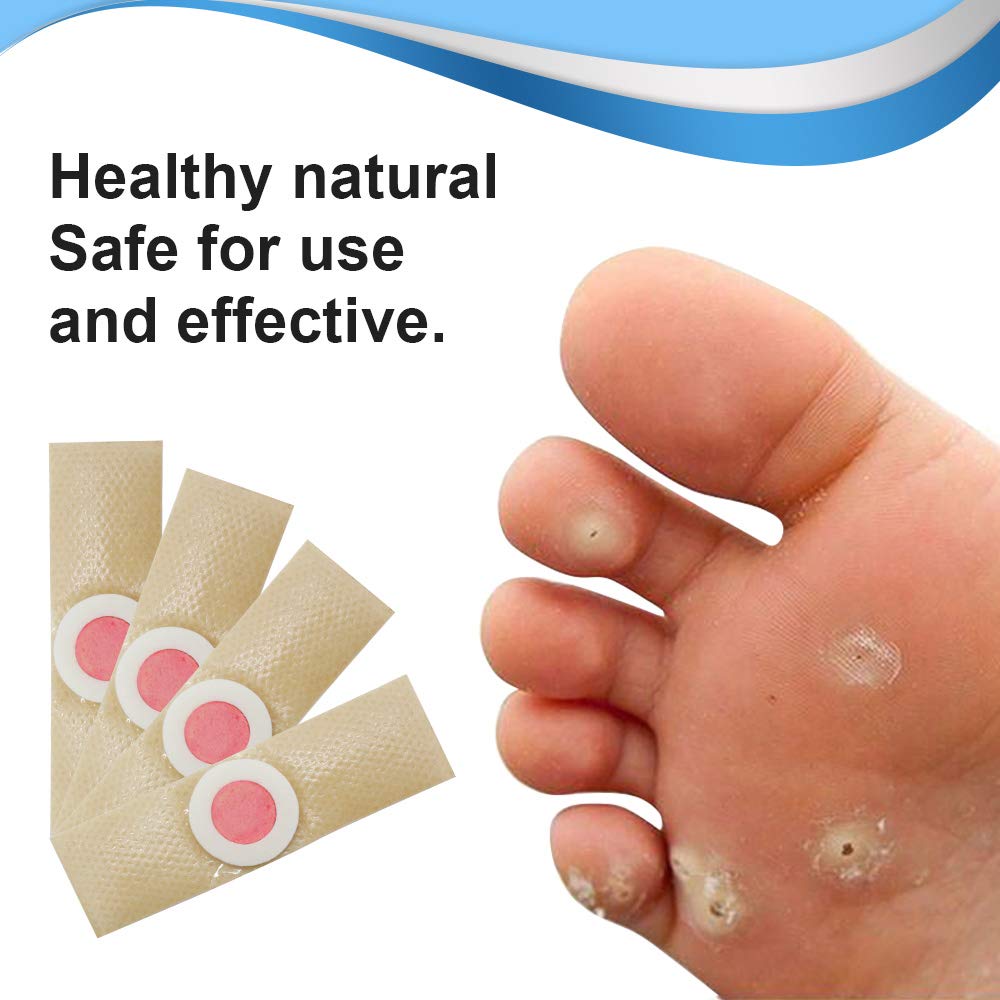 GNAPY Wart Removal Plasters, 24Pcs Wart Remover for Hands Feet Corn Removal Plaster with Hole, Remover Plantar Warts, Callus, Stops Wart Regrowth (A)