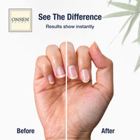 Onsen Secret Ultimate Nail Reboot Kit - Professional Nail File and Buffer, 3-Way Block w/Replacement Pads, Nail Strengthening Cuticle Cream, Reboot Oil & Anti Aging Hand Lotion
