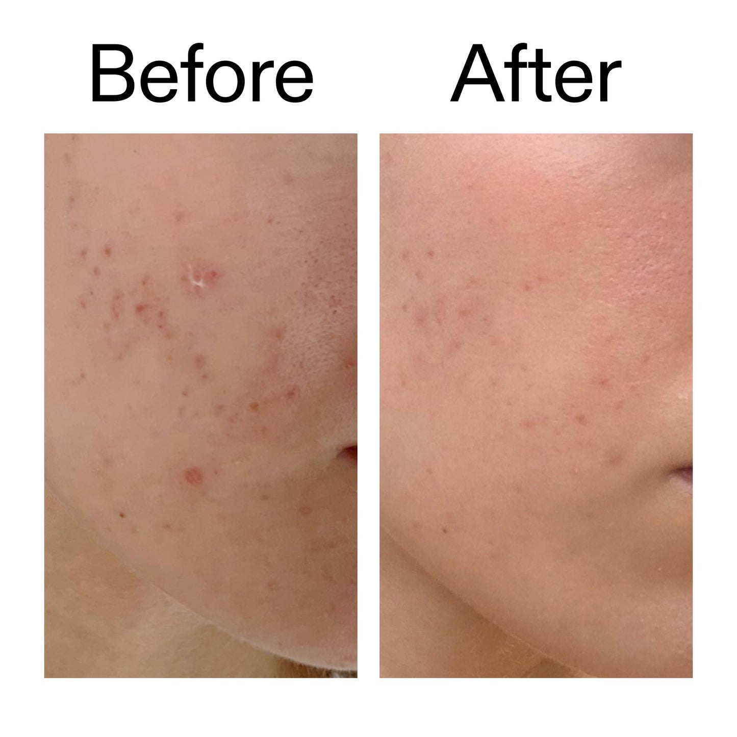 The INKEY List Mandelic Acid Treatment 15ml