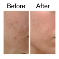 The INKEY List Mandelic Acid Treatment 15ml