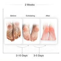 PALMARISA Foot Peel Mask Peach 2 Pack Softens Hard Skin, Repairs Cracked Heels, Exfoliates, Moisturises, Removes Heel Calluses, Improves Skin Texture, Revitalises Tired Feet, Clinically Tested, Palmarisa