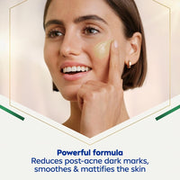 NIVEA Luminous 630 Post-Acne Dark Marks Serum (30ml), Facial Serum Visibly Reduces Post-Acne Dark Marks, Face Serum for Smooth, Refined, Glowing Skin