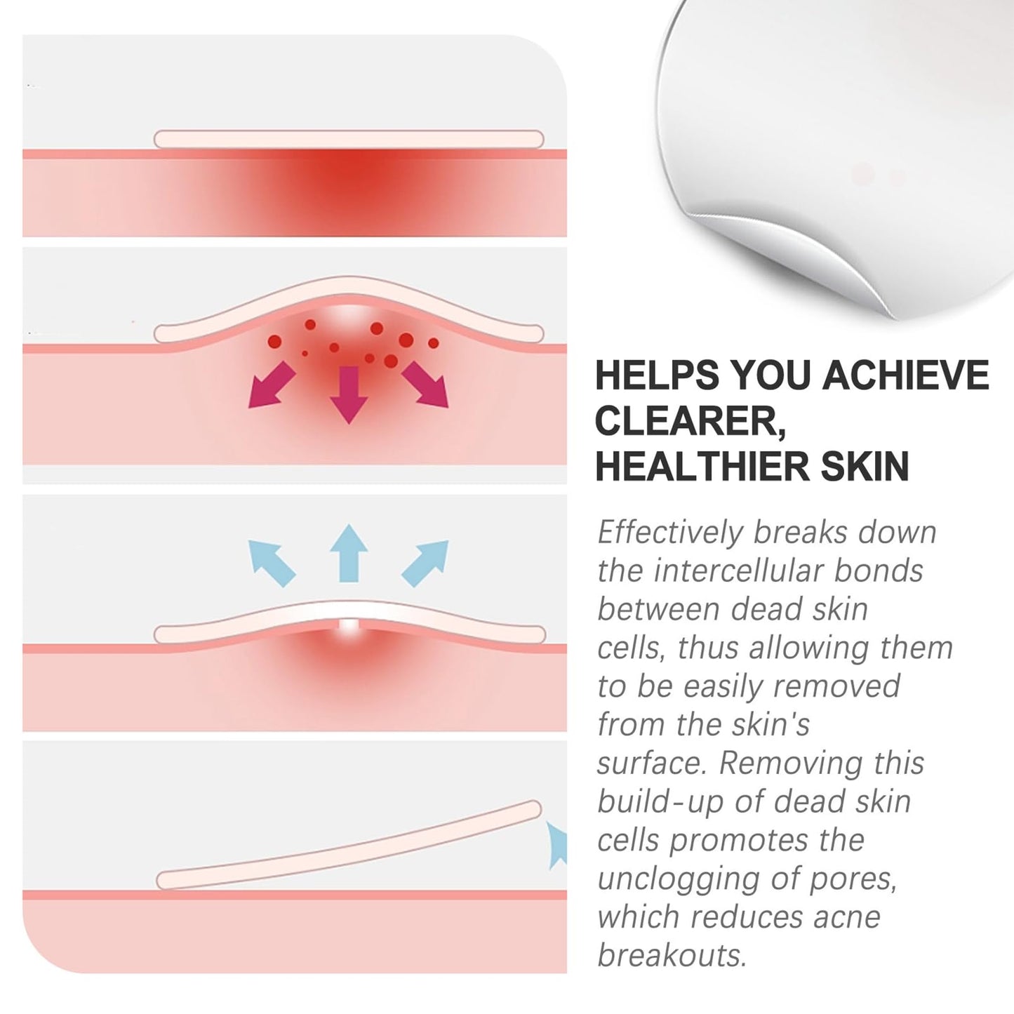 HERBENJOY Hydrocolloid Pimple Patches Spot Patches 144 Count Absorbing Cover Invisible Blemish Spot Treatment Facial Fast Acting Skincare Acne Patch Day and Night Use Acne Patches for Face