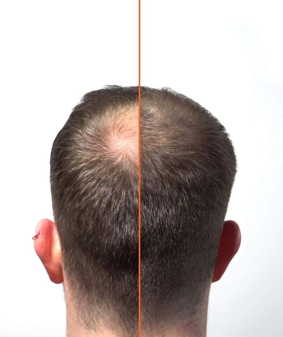 HairLab 100% Organic Hair-Thickening Keratin Fibres for Concealing Hair Loss and Thinning Hair -15g Dark Brown