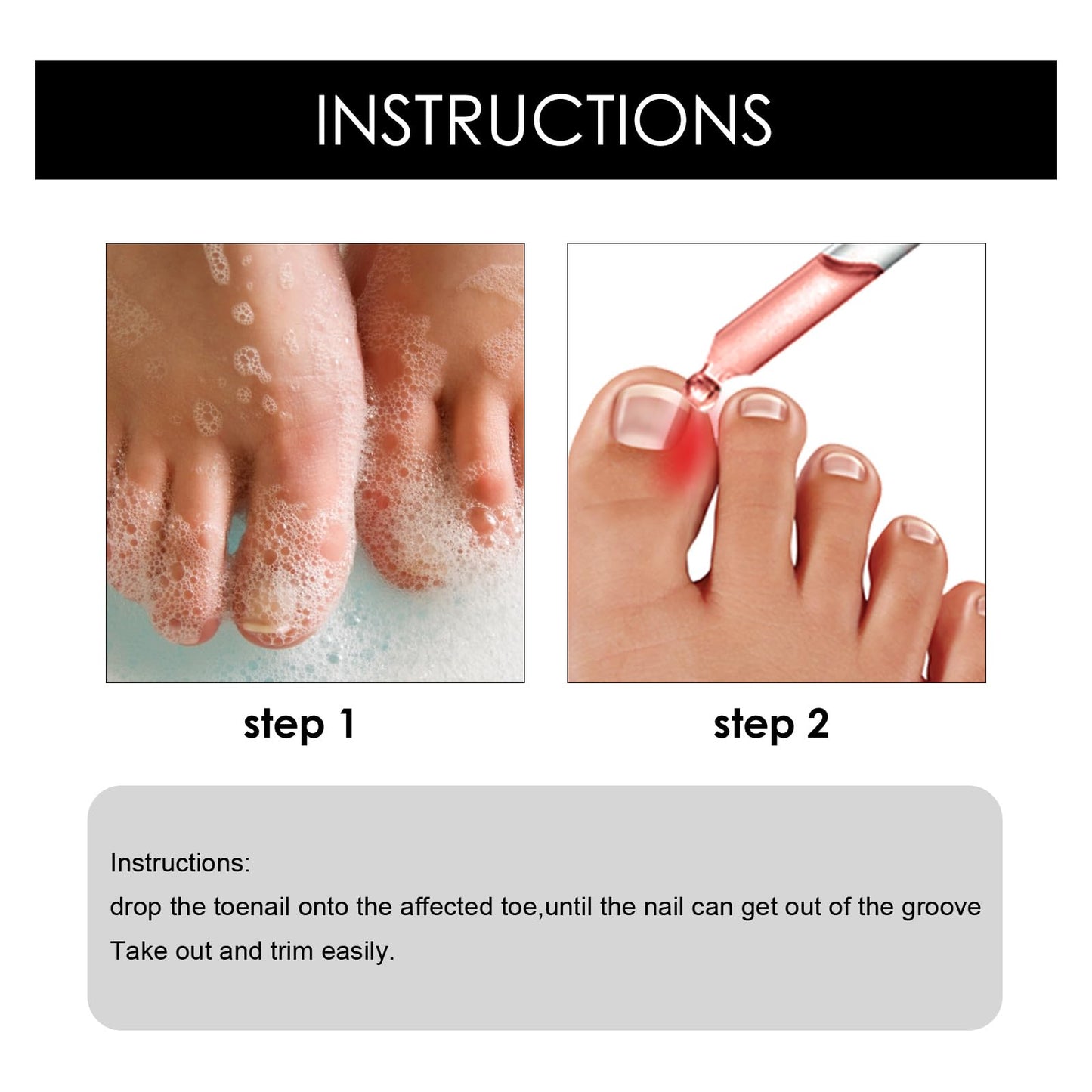 Fashion Base Ingrown Toenail Treatment Drop - Ingrown Toenail Treatment- Cuticle Care Oils for Ingrown Toenails - Trimming Toenail Softening Drops Natural Ingrown Toenail Correction Fungal Nail - 10ml