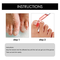 Fashion Base Ingrown Toenail Treatment Drop - Ingrown Toenail Treatment- Cuticle Care Oils for Ingrown Toenails - Trimming Toenail Softening Drops Natural Ingrown Toenail Correction Fungal Nail - 10ml
