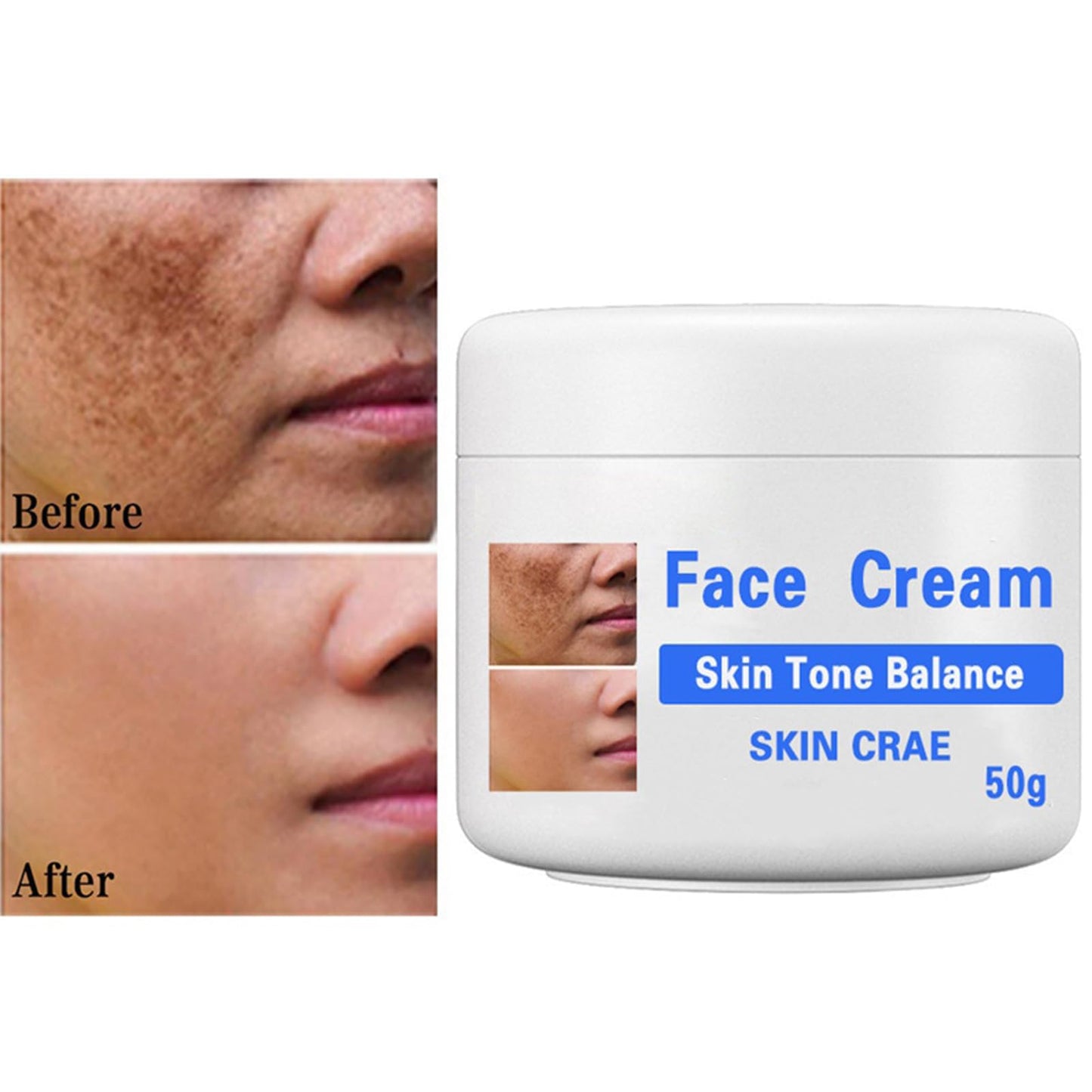 GNAUMORE Dark Spot Corrector Cream,Sun Spots and Melasma Freckle Remover,Spot Remover For Face Serum,Moisturizing Removes Facial Melasma Dark Spots Wrinkles Blemishes 50G