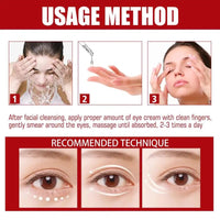 MrCuvaryas Milia Remover, Milia Spot Serum for Face, Milia Spot Removal Helps to Ruduce Milia, Dark Circles Under Eye for Women & Men, Anti Aging Anti Wrinkle, Reduces Bags, Saggy Skin & Puffy Eyes (1PCS)
