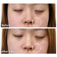 Dermaflage Cover Up - Concealer for Scars, Frown Lines from Hollywood Pro