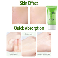 FPNNZ Aloe vera Gel For Skin Care, Aloe Vera Gel For Face, 99% Pure Aloe Vera Gel With Vitamin E, Aloevera Gel For Skin Care, Aloe Vera Gel, Itchy & Damaged Skin, Aloevera Gel For Skin CareAloevera Sunburn