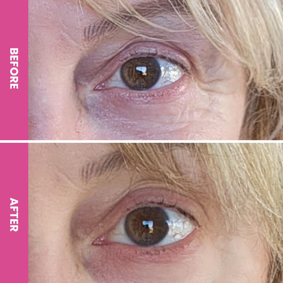 PRIME PROMETICS Prime Prometics PrimeEyes Hydrate Under Eye Cream for Mature Women – Hydrating Eye Cream for Dark Circles and Wrinkle Repair – Soft, Glowing & Healthy Under Eyes