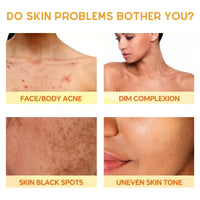 Kojic Acid Soap, Kojic Soap Bar Skin Lightening Soap Bath Soap, Fades Age Spots, Freckles, Revitalize and Moisturizing Cleansing Soap for Dark Spots, Uneven Skin Tone